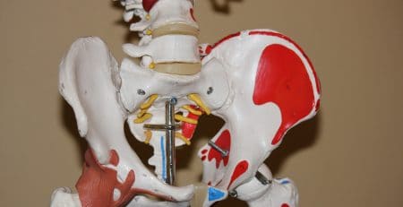 Vista detallada del esqueleto de la cadera humana, ilustrando la zona donde se realiza la cirugía de prótesis de cadera para reemplazar la articulación dañada