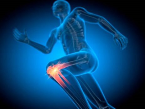 condromalacia rotuliana