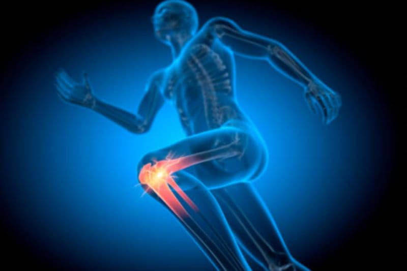 condromalacia rotuliana